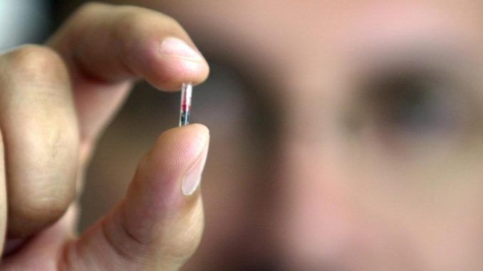 microchips-1-kPz--1248x698@abc